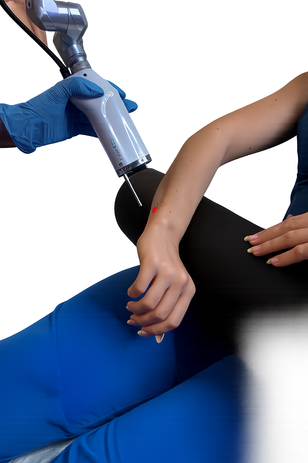 Laser Tattoo Removal